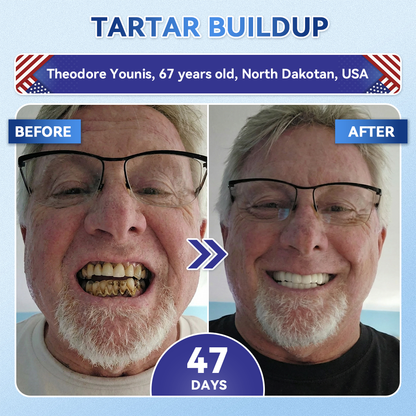 Your Smile~ Acezozla® 🦷 Tideglusib Fast‑Dissolving Tooth & Gum Repair Oral Strips ✨ (𝟓-𝐢𝐧-𝟏 💎 𝐑𝐞𝐛𝐮𝐢𝐥𝐝 𝐄𝐧𝐚𝐦𝐞𝐥 & 𝐃𝐞𝐧𝐭𝐢𝐧 • 𝐒𝐭𝐫𝐞𝐧𝐠𝐭𝐡𝐞𝐧 𝐆𝐮𝐦𝐬 • 𝐄𝐫𝐚𝐝𝐢𝐜𝐚𝐭𝐞 𝐓𝐚𝐫𝐭𝐚𝐫 & 𝐎𝐝𝐨𝐫 • 𝐖𝐡𝐢𝐭𝐞𝐧𝐢𝐧𝐠 • 𝐒𝐭𝐨𝐩 𝐓𝐨𝐨𝐭𝐡 𝐒𝐞𝐧𝐬𝐢𝐭𝐢𝐯𝐢𝐭𝐲)