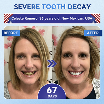 Your Smile~ Acezozla® 🦷 Tideglusib Fast‑Dissolving Tooth & Gum Repair Oral Strips ✨ (𝟓-𝐢𝐧-𝟏 💎 𝐑𝐞𝐛𝐮𝐢𝐥𝐝 𝐄𝐧𝐚𝐦𝐞𝐥 & 𝐃𝐞𝐧𝐭𝐢𝐧 • 𝐒𝐭𝐫𝐞𝐧𝐠𝐭𝐡𝐞𝐧 𝐆𝐮𝐦𝐬 • 𝐄𝐫𝐚𝐝𝐢𝐜𝐚𝐭𝐞 𝐓𝐚𝐫𝐭𝐚𝐫 & 𝐎𝐝𝐨𝐫 • 𝐖𝐡𝐢𝐭𝐞𝐧𝐢𝐧𝐠 • 𝐒𝐭𝐨𝐩 𝐓𝐨𝐨𝐭𝐡 𝐒𝐞𝐧𝐬𝐢𝐭𝐢𝐯𝐢𝐭𝐲)