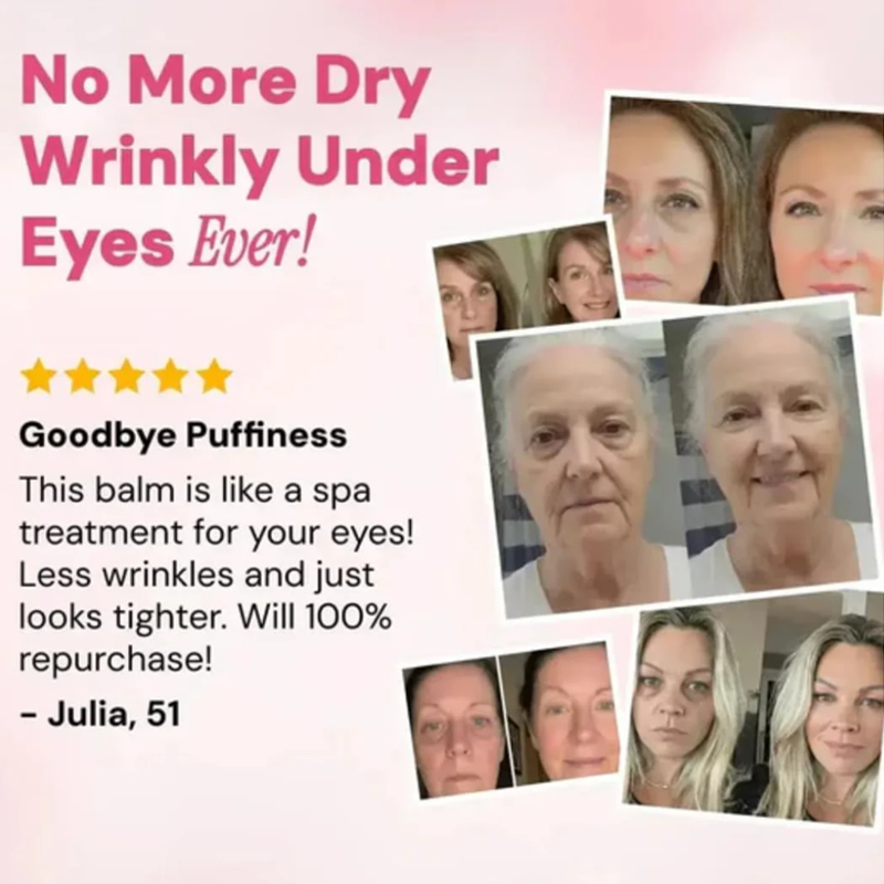 Revive Tired Eyes – Hydrating & Anti-Wrinkle Eye Balm