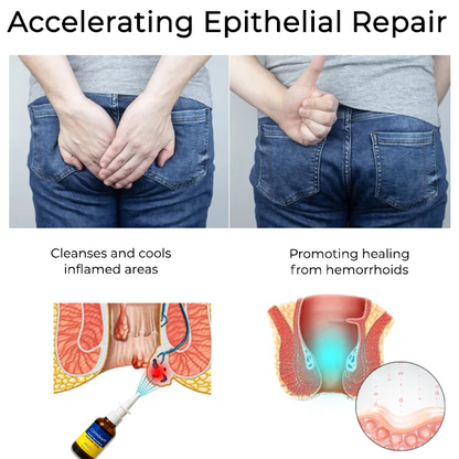 Coredew® Herbal Hemorrhoid Treatment Anal Spray Pro