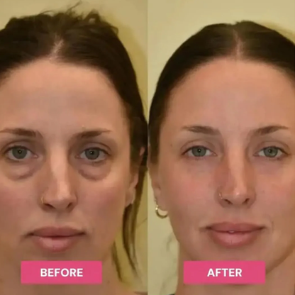 Revive Tired Eyes – Hydrating & Anti-Wrinkle Eye Balm